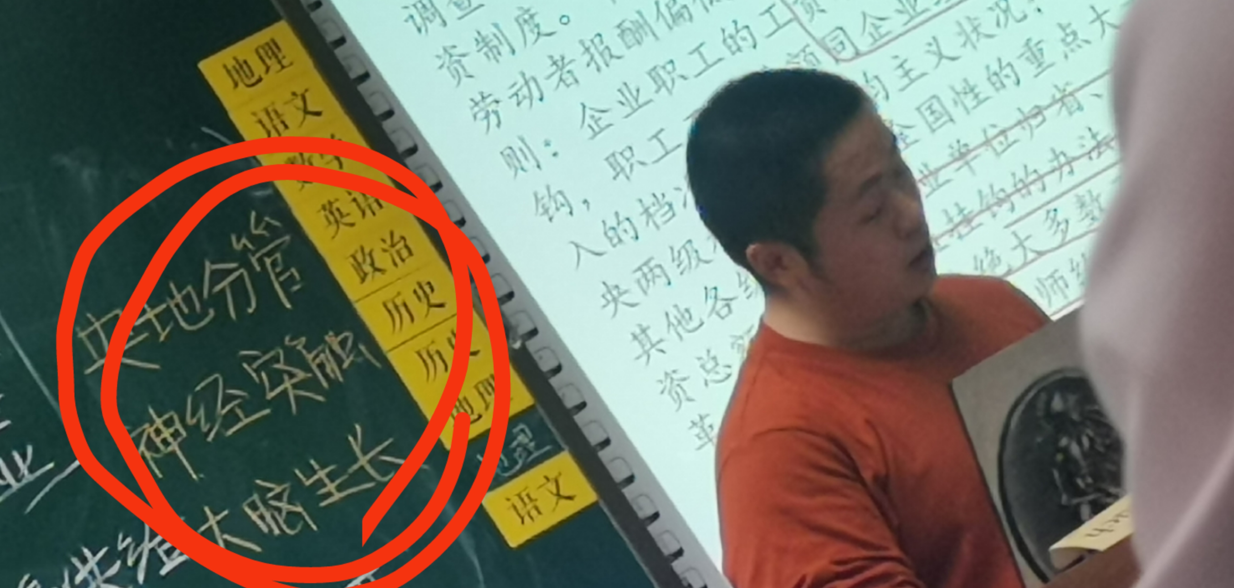 TNNLN7I3AAQCG